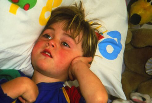 درد ناشی از عفونت گوش کودکان